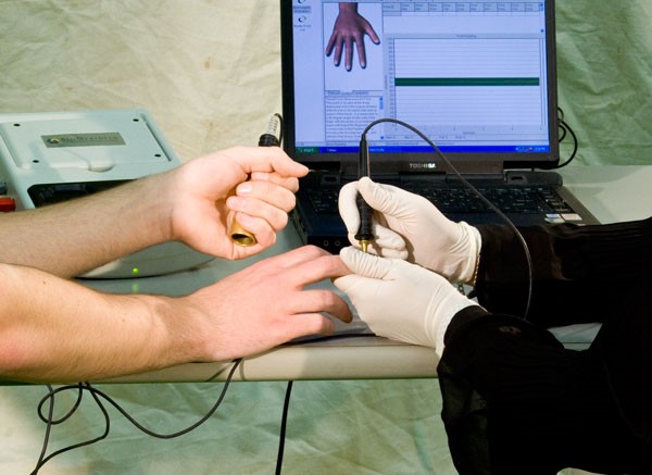 mobile electrodermal screening